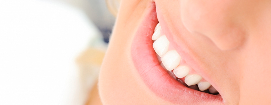 Teeth whitening should always be done under the supervision of a dentist.

