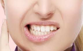 Dental Bruxism: discover the causes, symptoms and treatment to put a solution