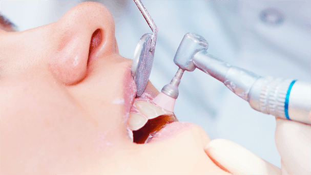 WHAT DOES A DENTAL CLEANING CONSIST OF?