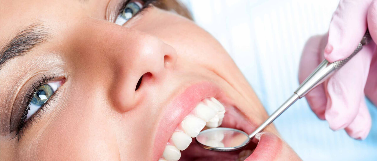 Deep Dental Cleaning: When to Do It