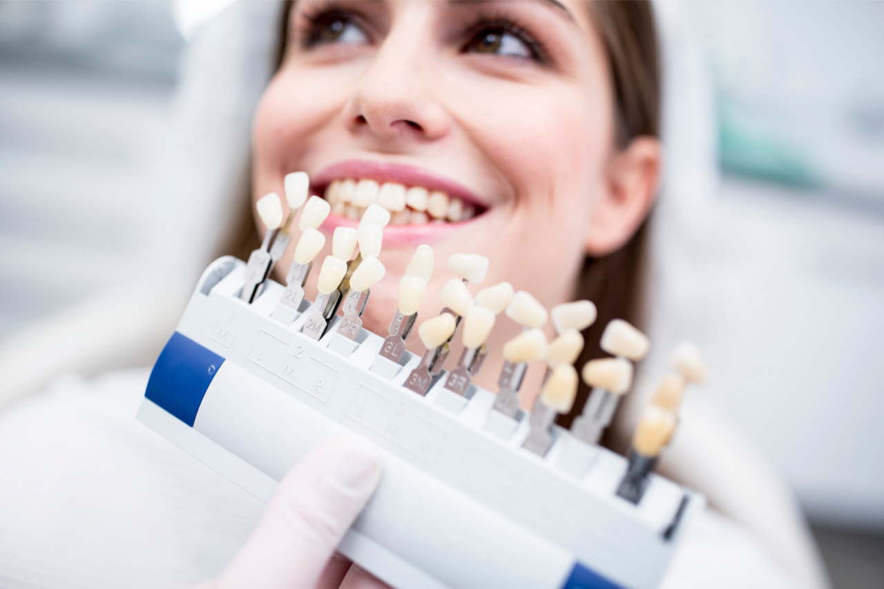 Dental veneers: types, characteristics and benefits