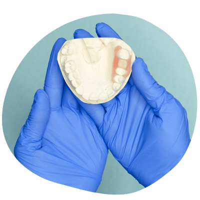 Prótesis dental personalizada realizada en el laboratorio de Top Dental