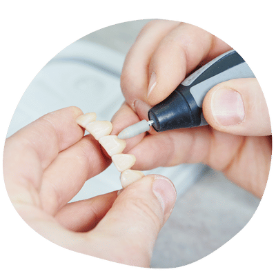 Prótesis Dental Personalizada en Top Dental