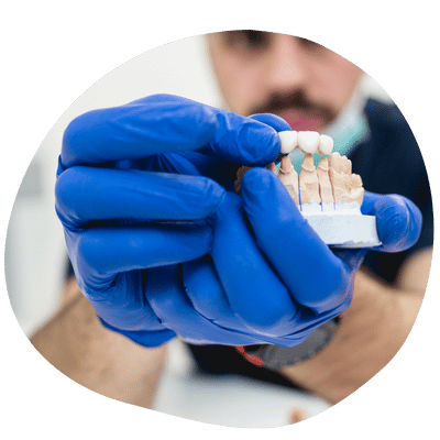 Prótesis dentales en Top Dental – Laboratorio Propio y Alta Precisión
