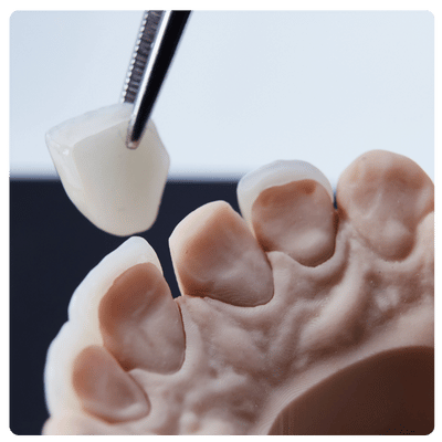 Corona Dental de Laboratorio Top Dental