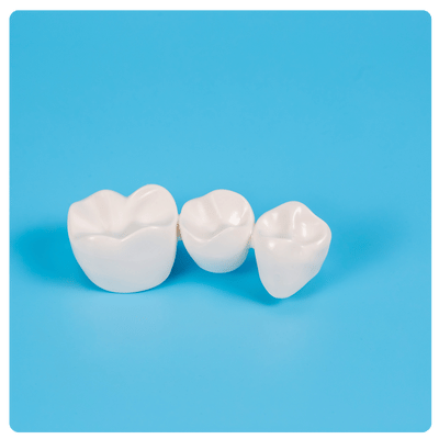 Puente Dental fijo