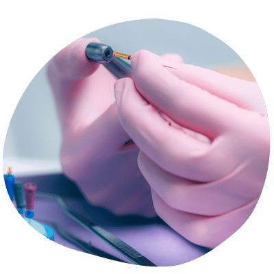 Tratamiento de conducto en Top Dental para aliviar el dolor dental