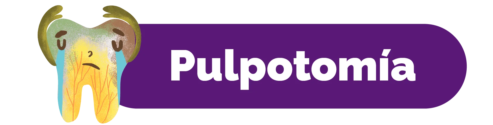 Pulpotomy