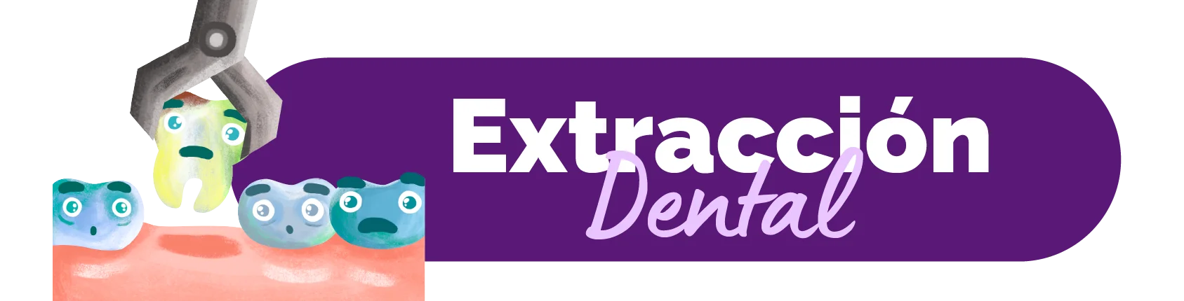 Tooth Extraction