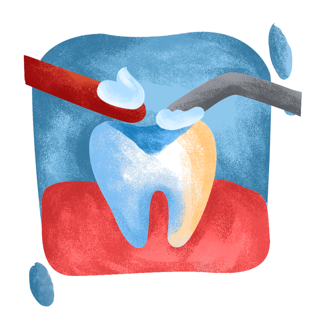 restorative, filling dental