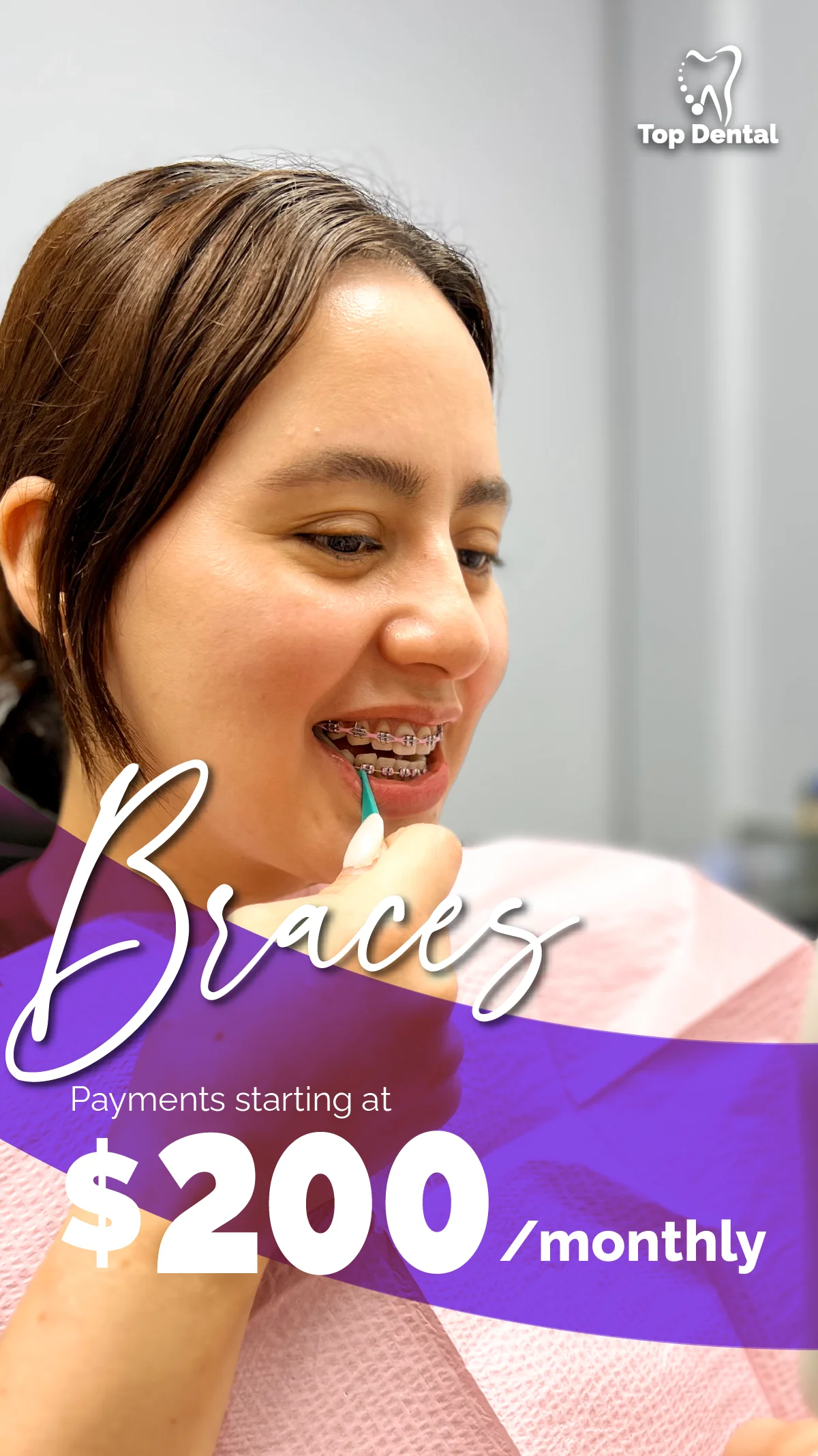 Braces Treatment - Top Dental