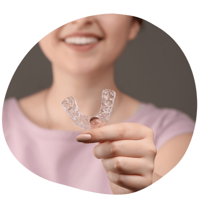 Custom Occlusal Guard at Top Dental