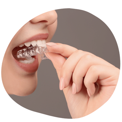 Patient wearing custom dental guard from Top Dental