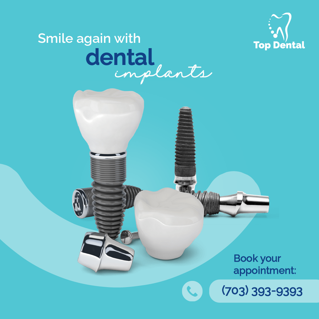 Dental Implant Top Dental