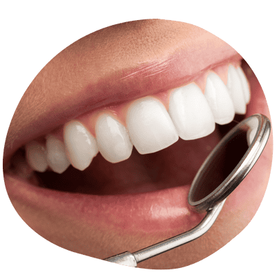 Dentist in Silver Spring MD