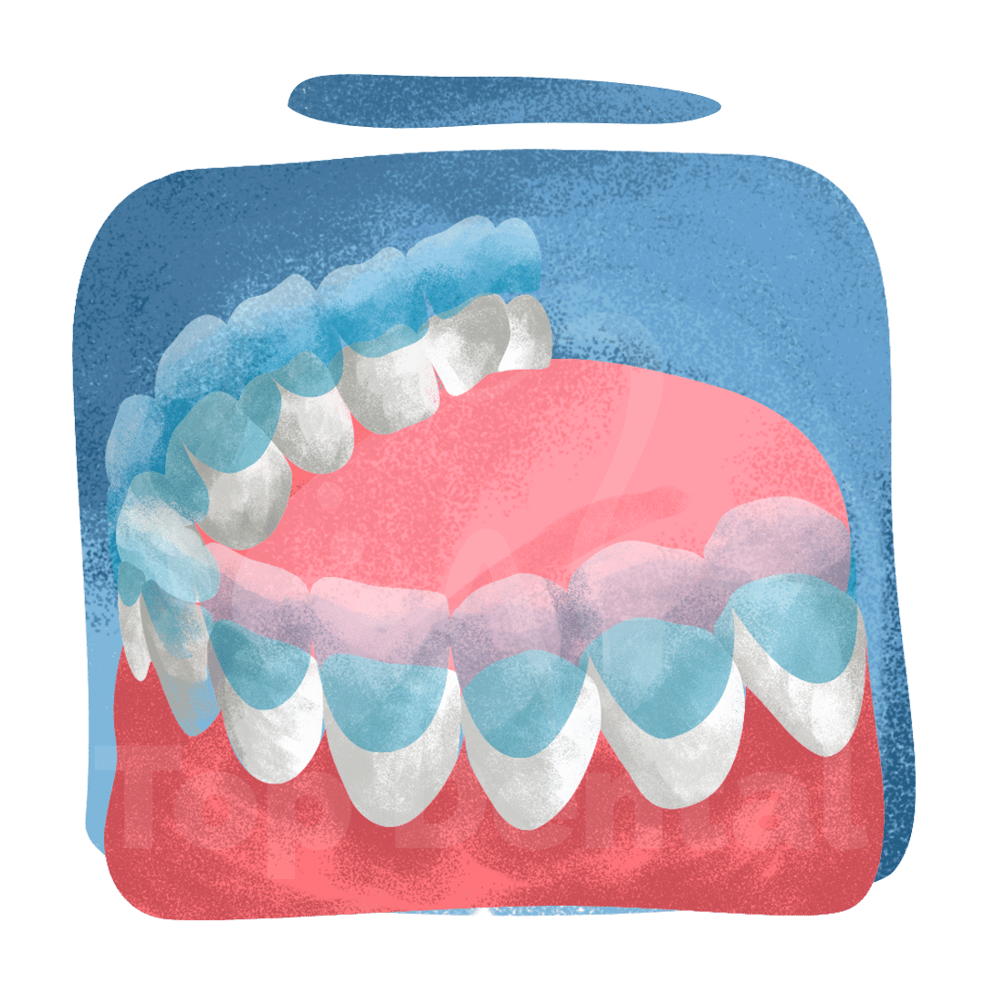 Invisible Braces, Aligners, Orthodontics Top Dental
