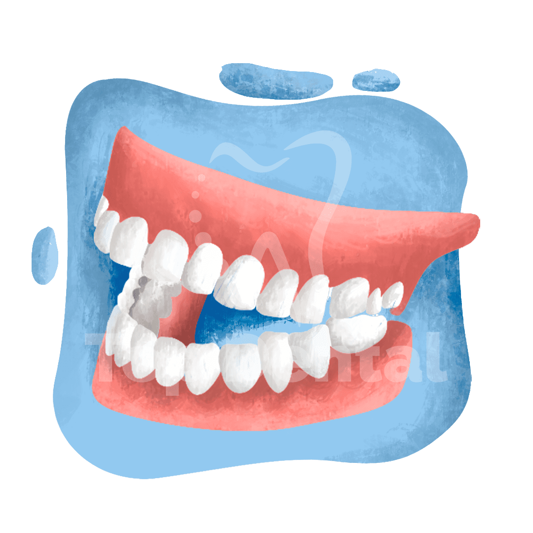 Complete Dentures Top Dental