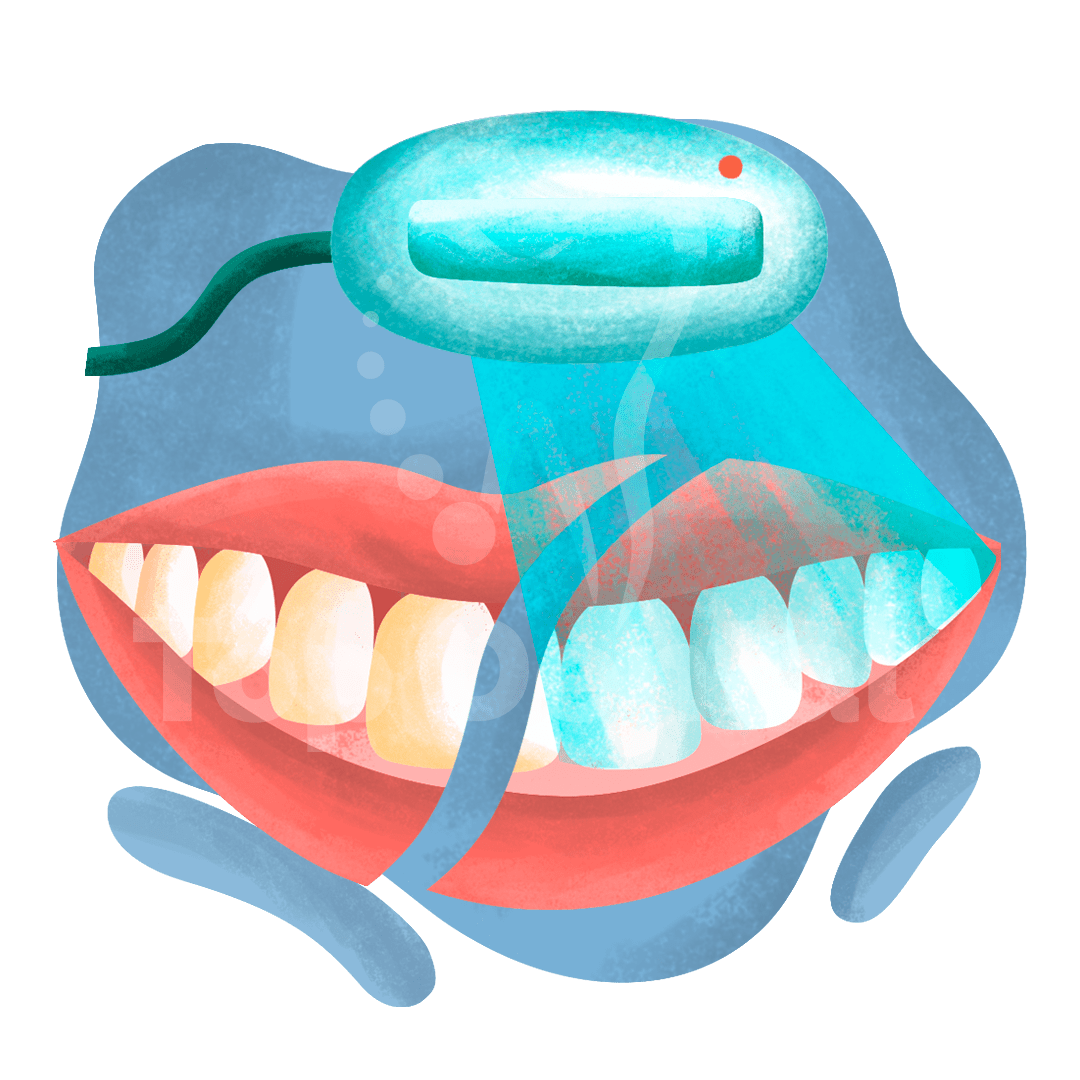 Teeth Whitening Top Dental